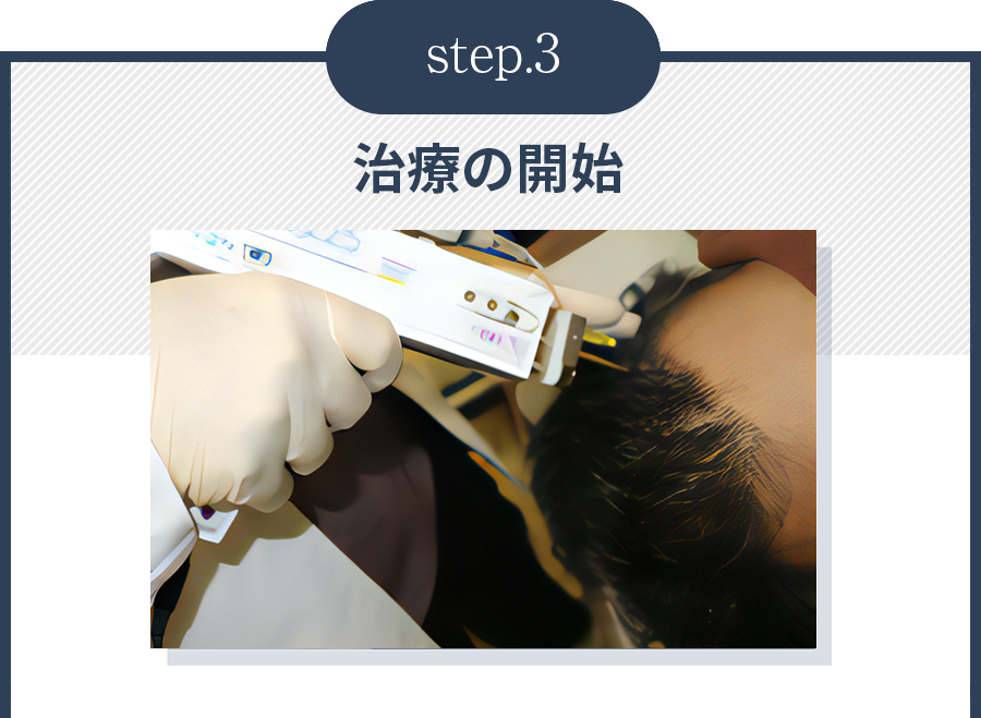 STEP03.治療の開始